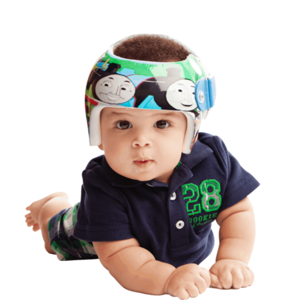 cascos ortopédicos para bebes